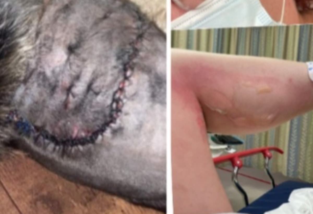 MyMotherGotCaughtInACarFire