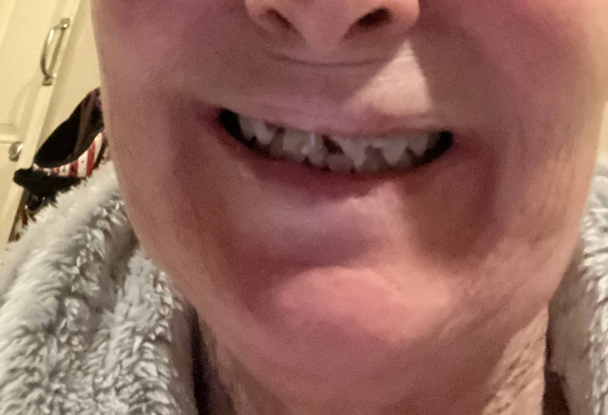 HelpMyMomSmileAgain