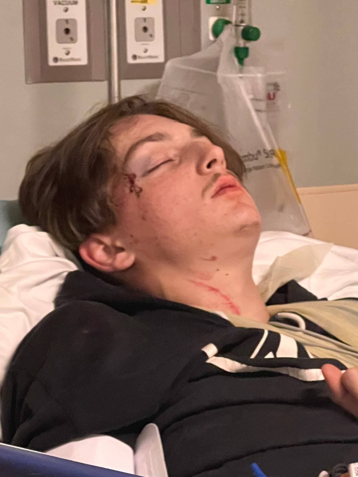HelpCameronFightEpilepsy