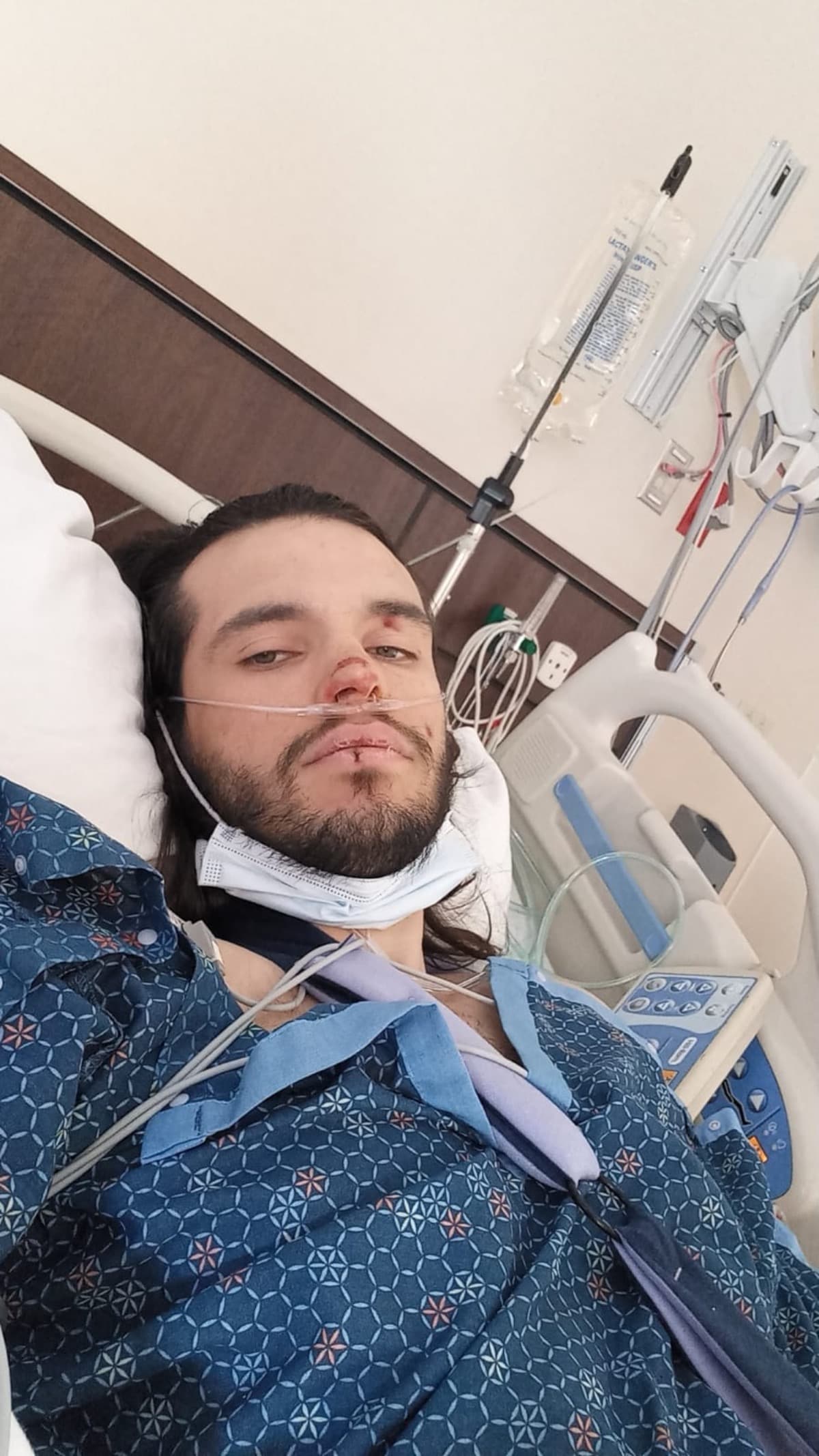 J1sCarCrashInColorado