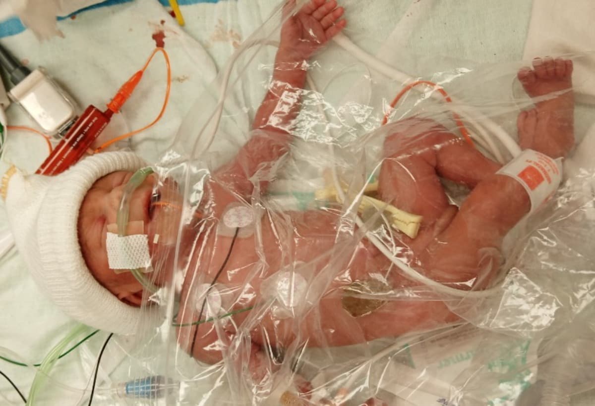 IcuWithNothingAndNoWereToGo