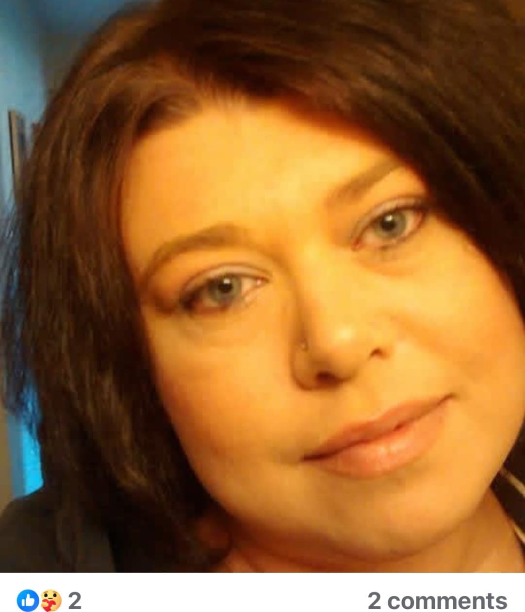 My Friend Lisa Tibbets Has Brain Cancer