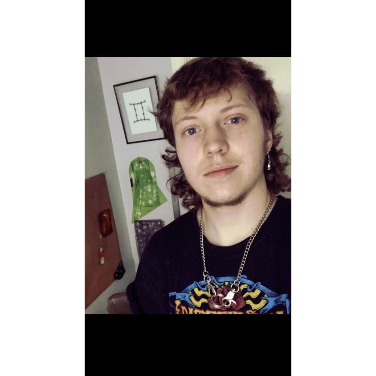 HelpMiloGetTopSurgery