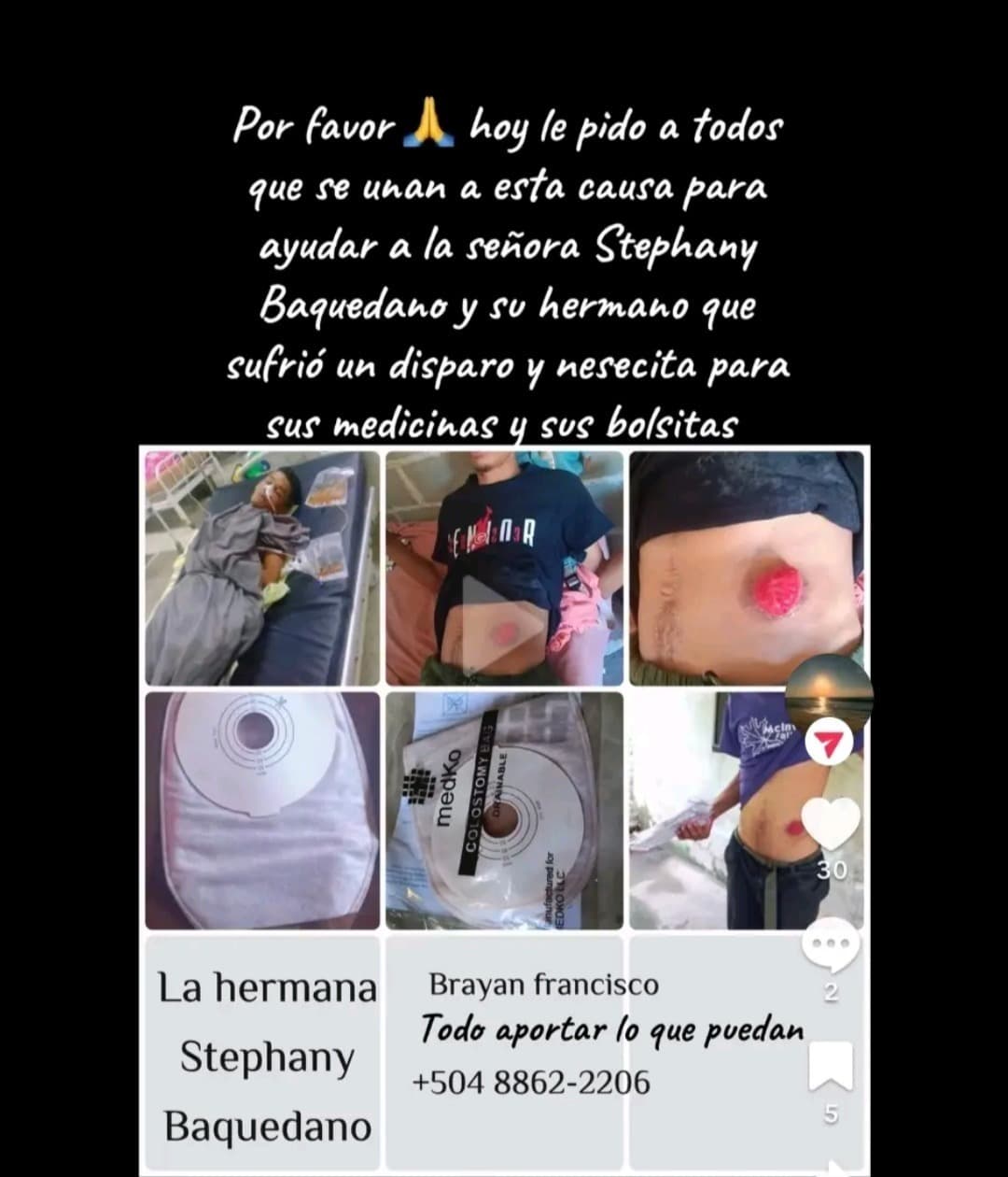 Operacion
