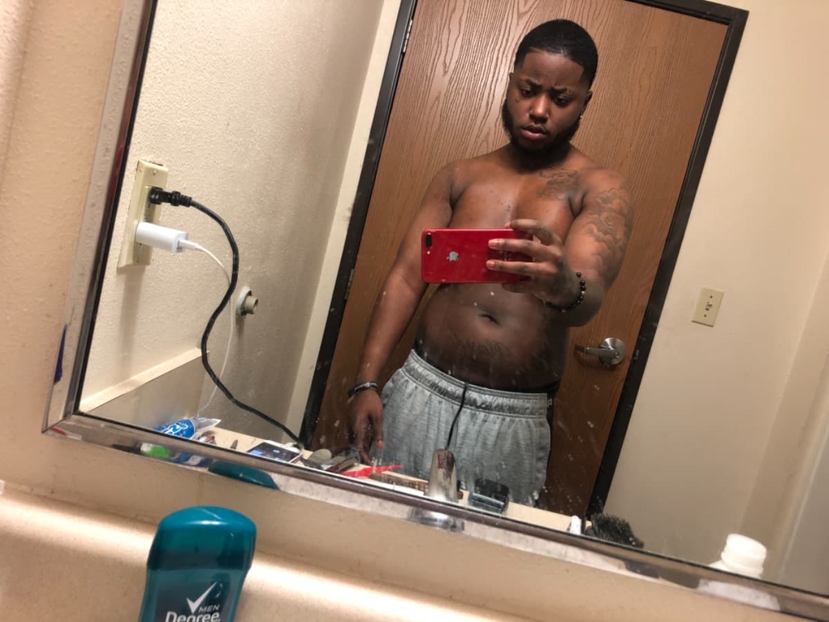TopSurgeryFund