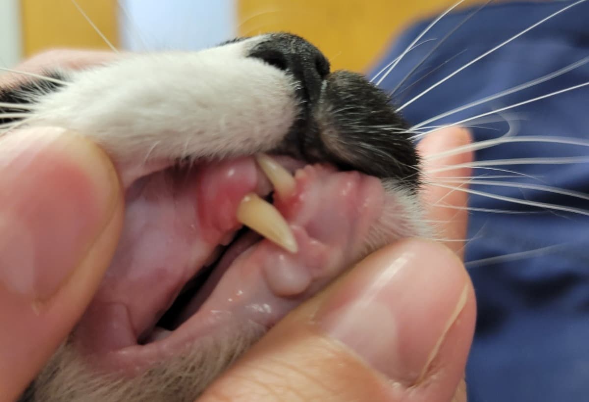 TeethRemovalProcedure