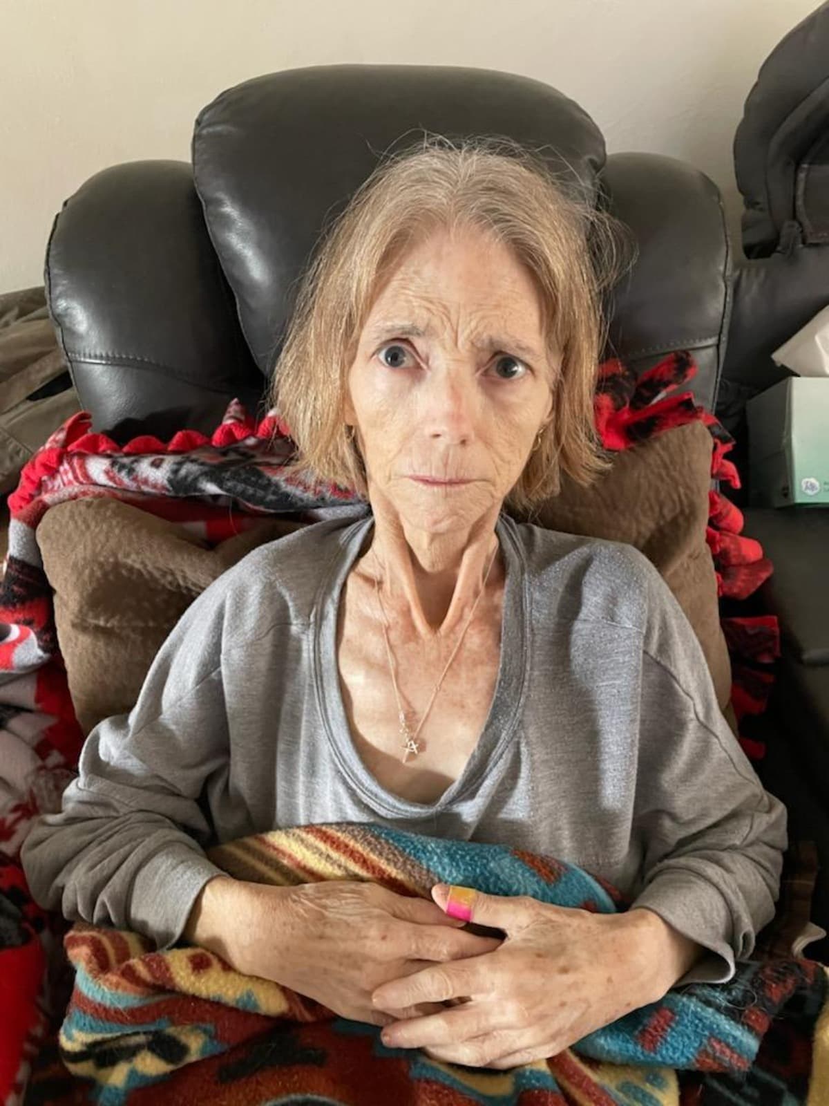 KimEllisStage4Cancer