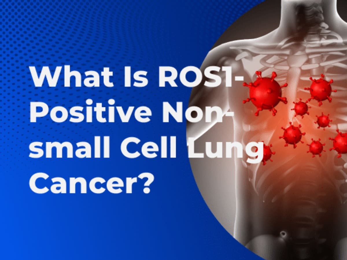 ROSLungCancerCure