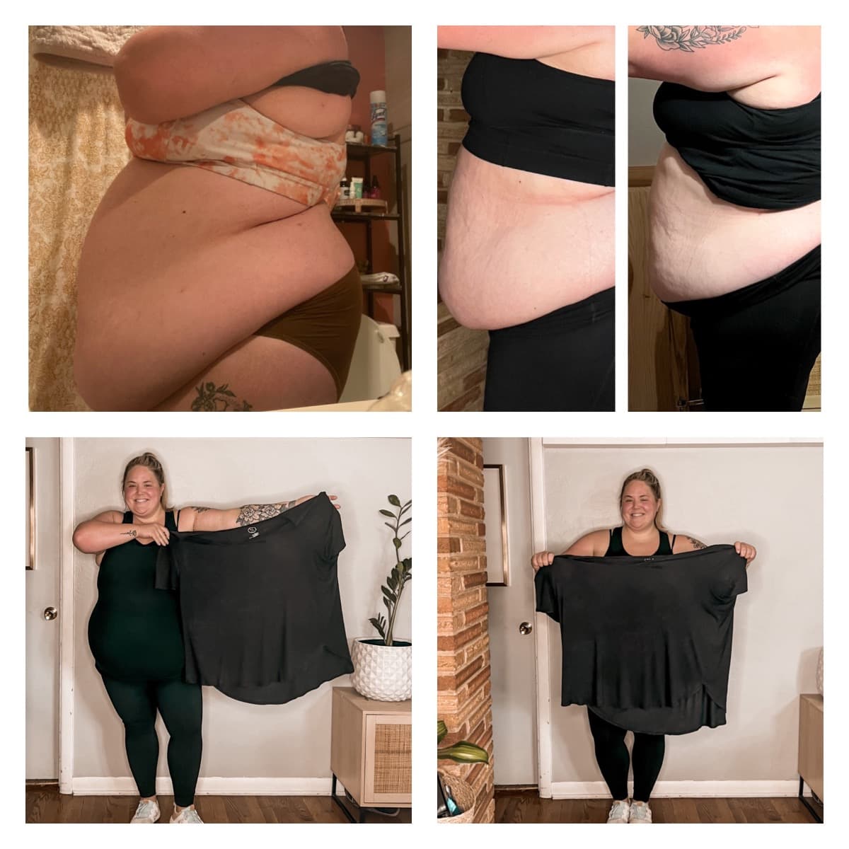 JourneyToWeightLossSurgery