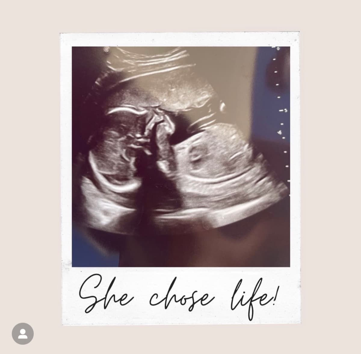 SinglePregnantMomCarPayment