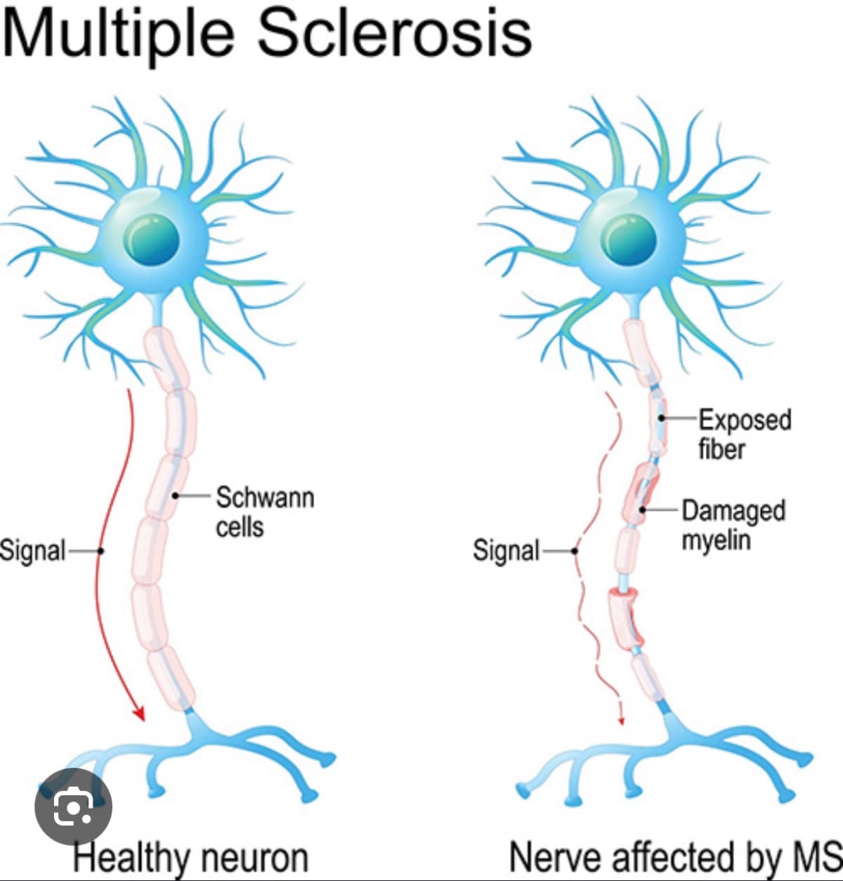 MakeAnMSJourneyLessStressful