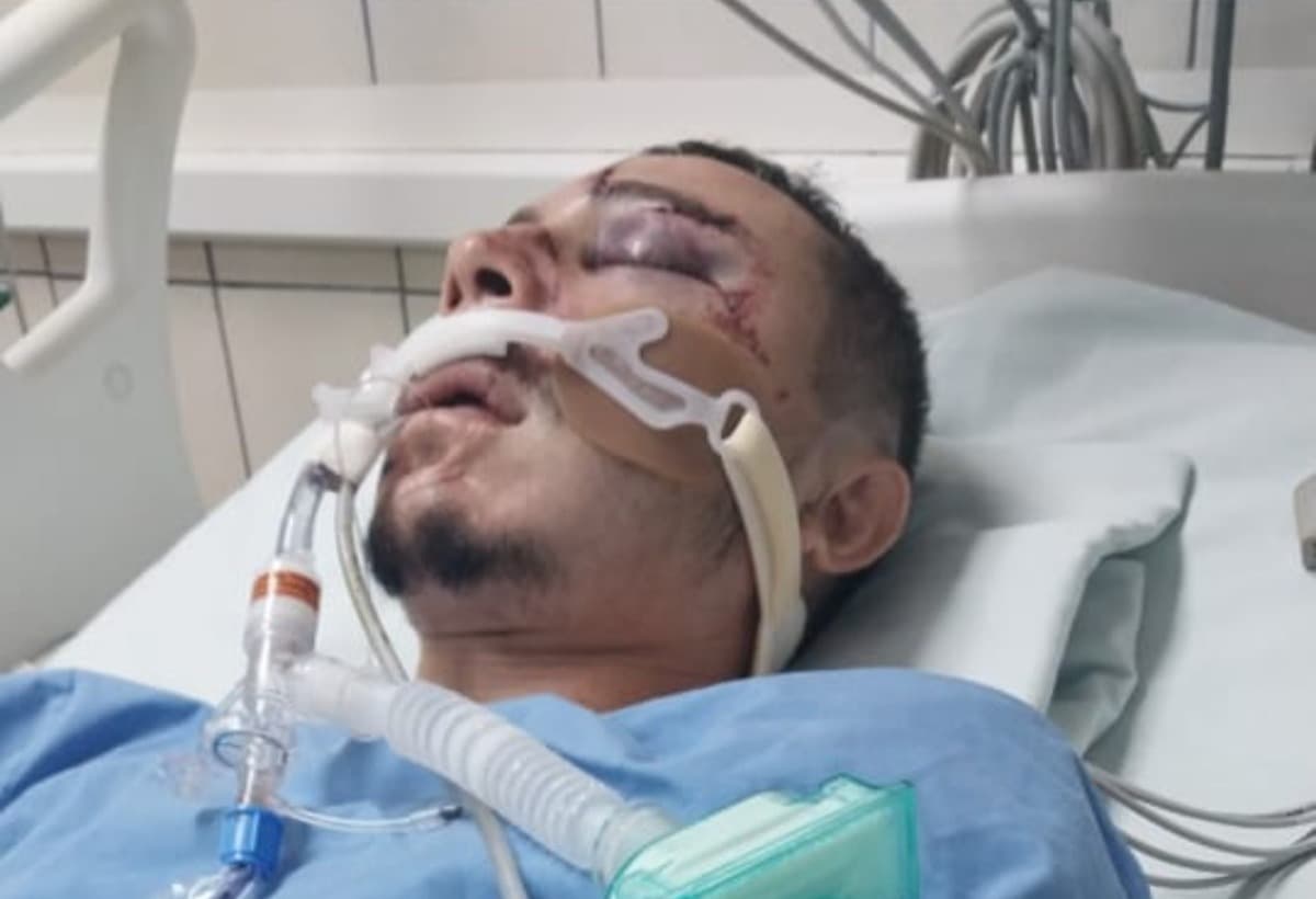 SevereMotorcycleAccident