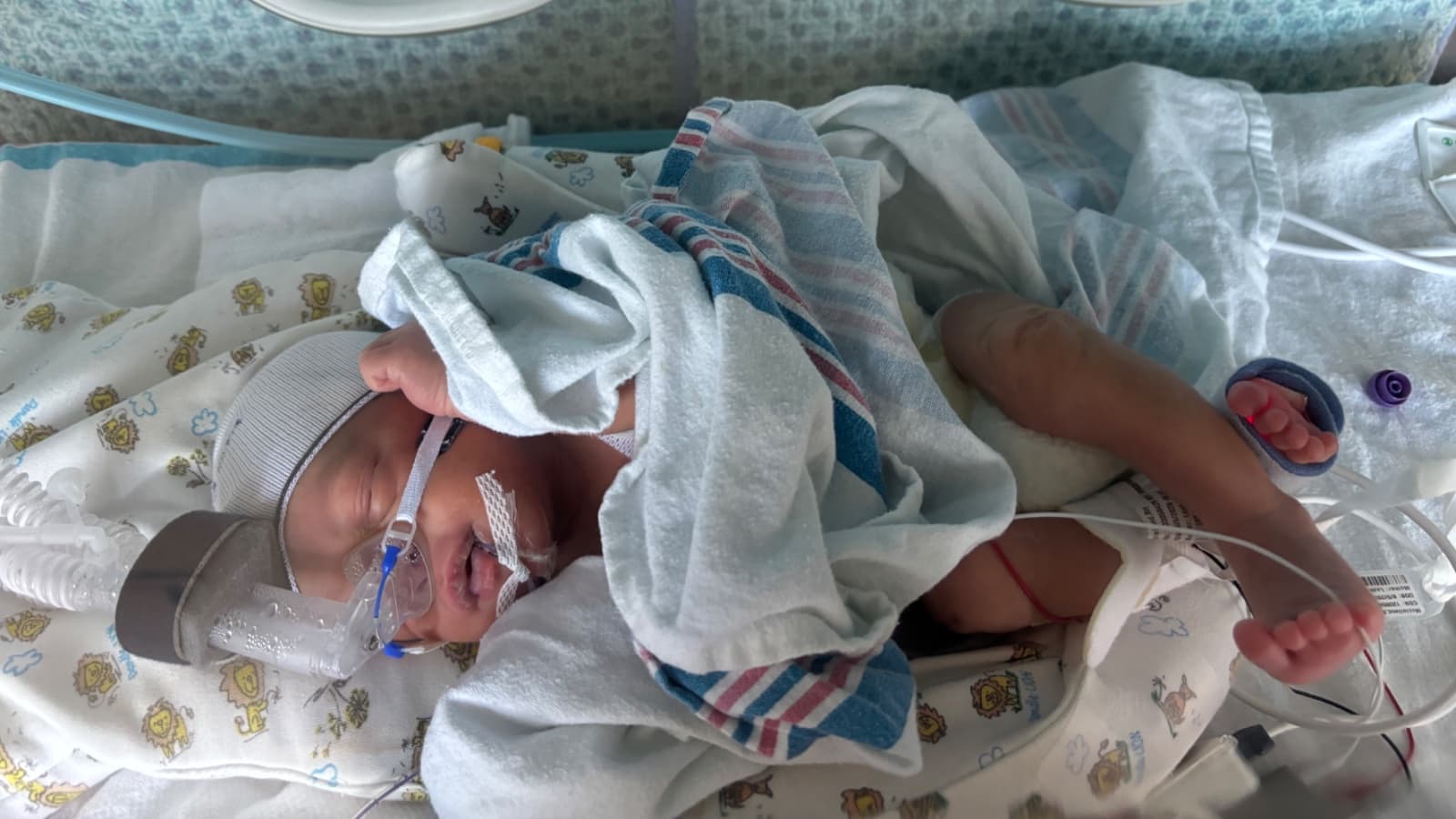 Help Baby Legend Thrive: Medical Fund