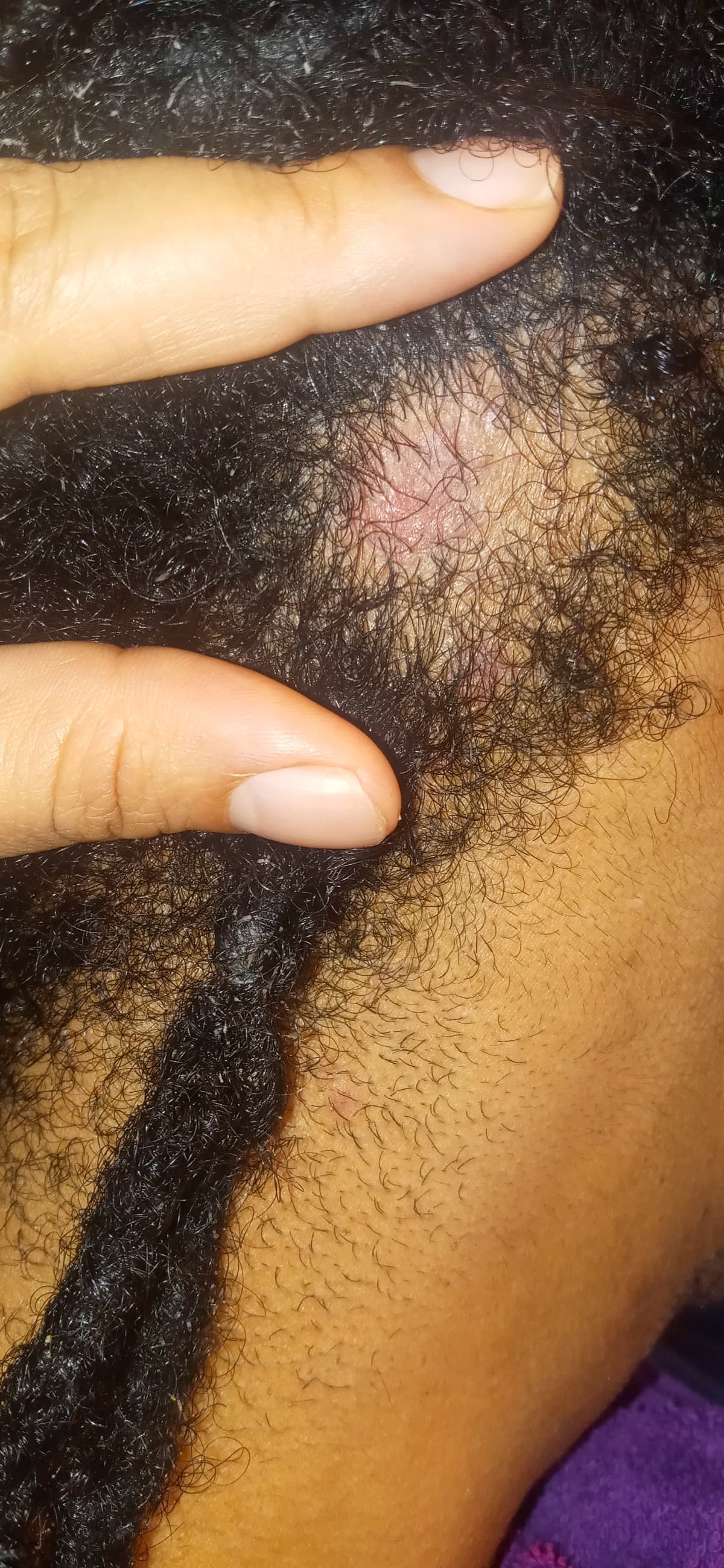 HelpHairLossAndScalpDisease