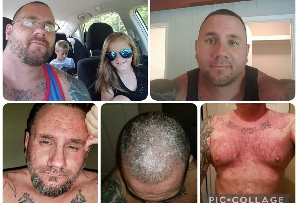 MedicalHelpForAdverseReaction