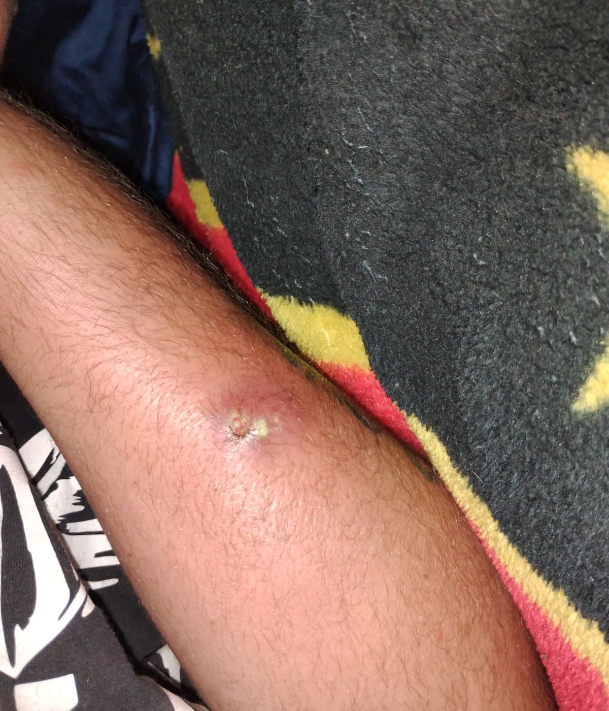 Help Fix Truck And Recover From Spider Bites