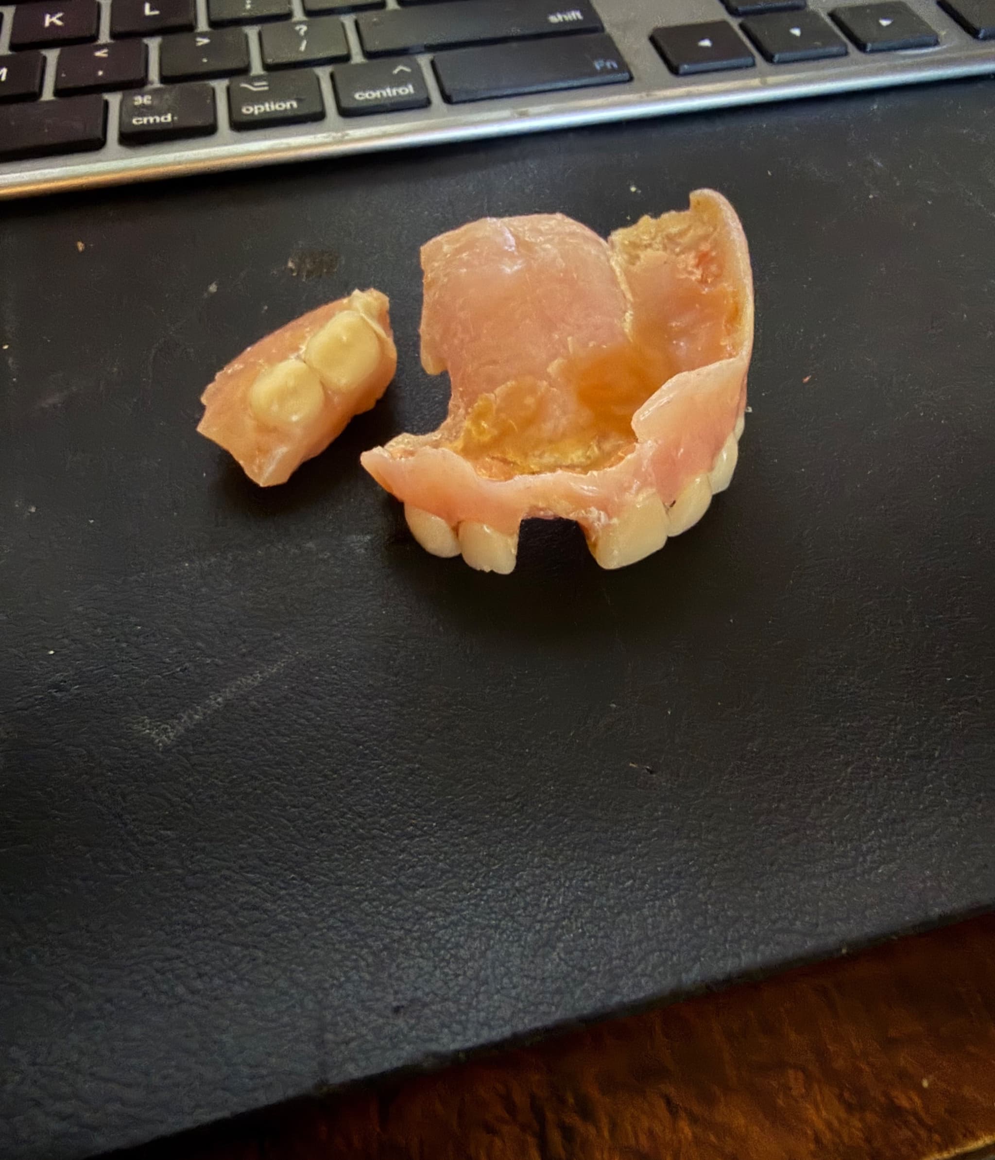 Help With Dentures