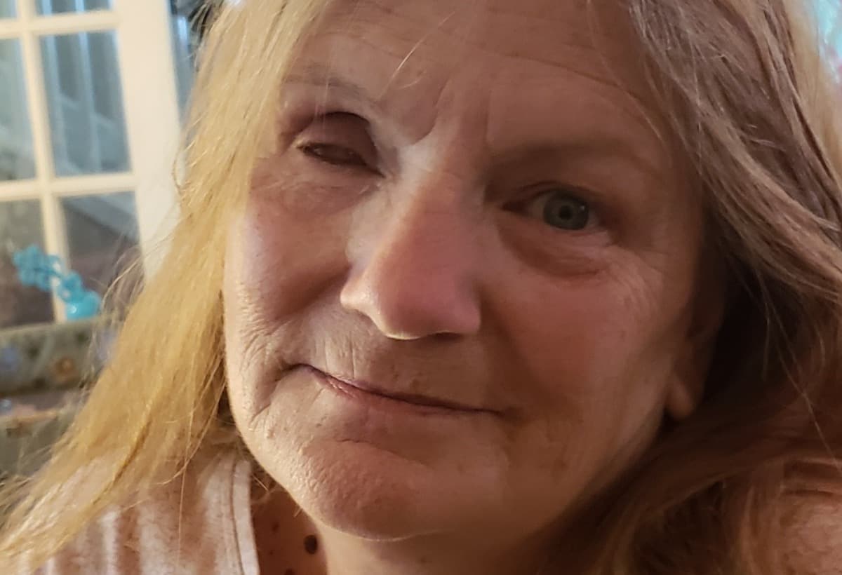 ProstheticEyeForCareBear