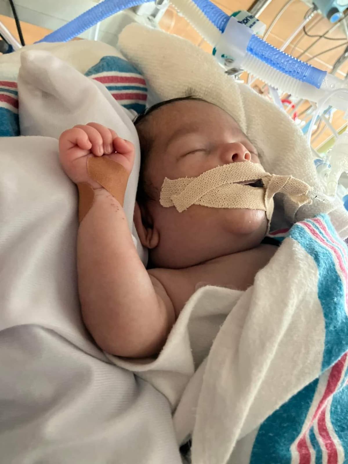 TwinBabiesInTheHospital