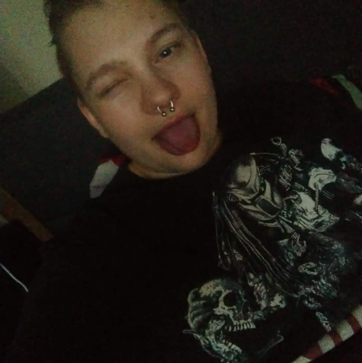 TransgenderSugery