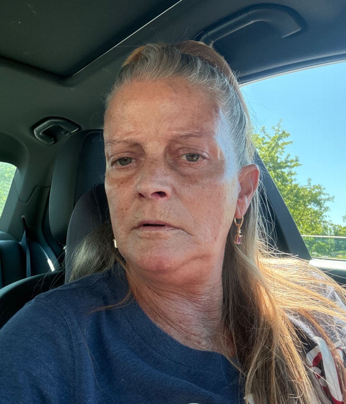 Help with bills due to being in the hospital