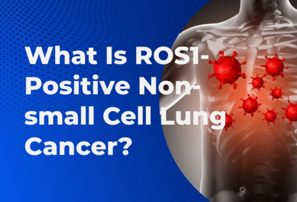 ROSLungCancerCure