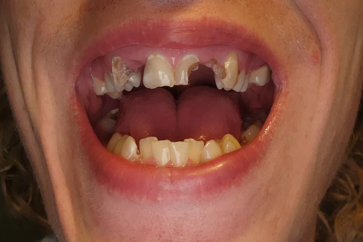 NeedHelpGettingDentalSurgery
