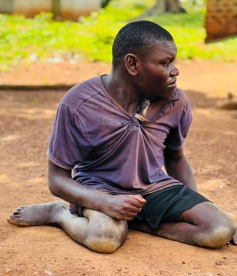 Urgent Medical Aid For Brother In Uganda