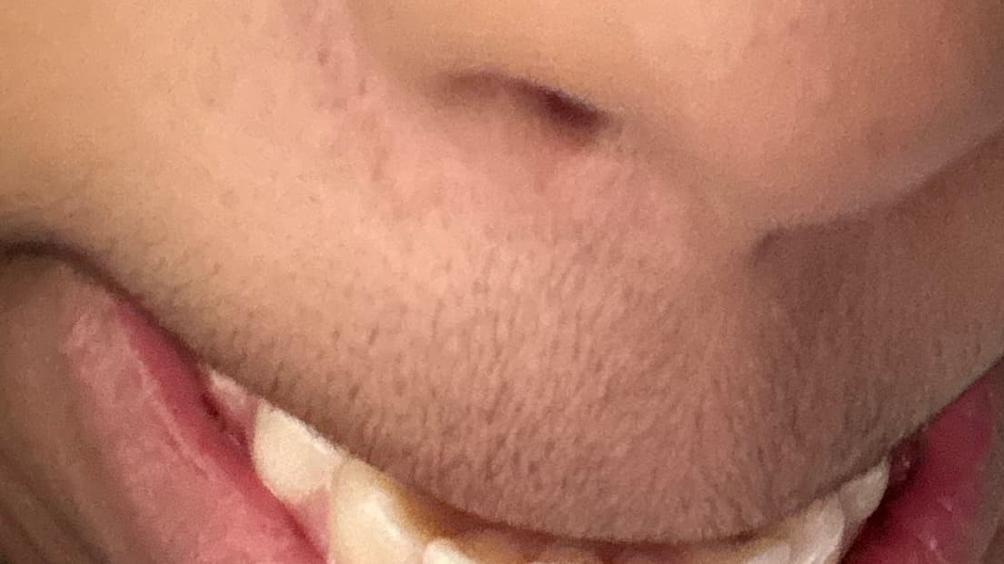 Smile Restoration Fund