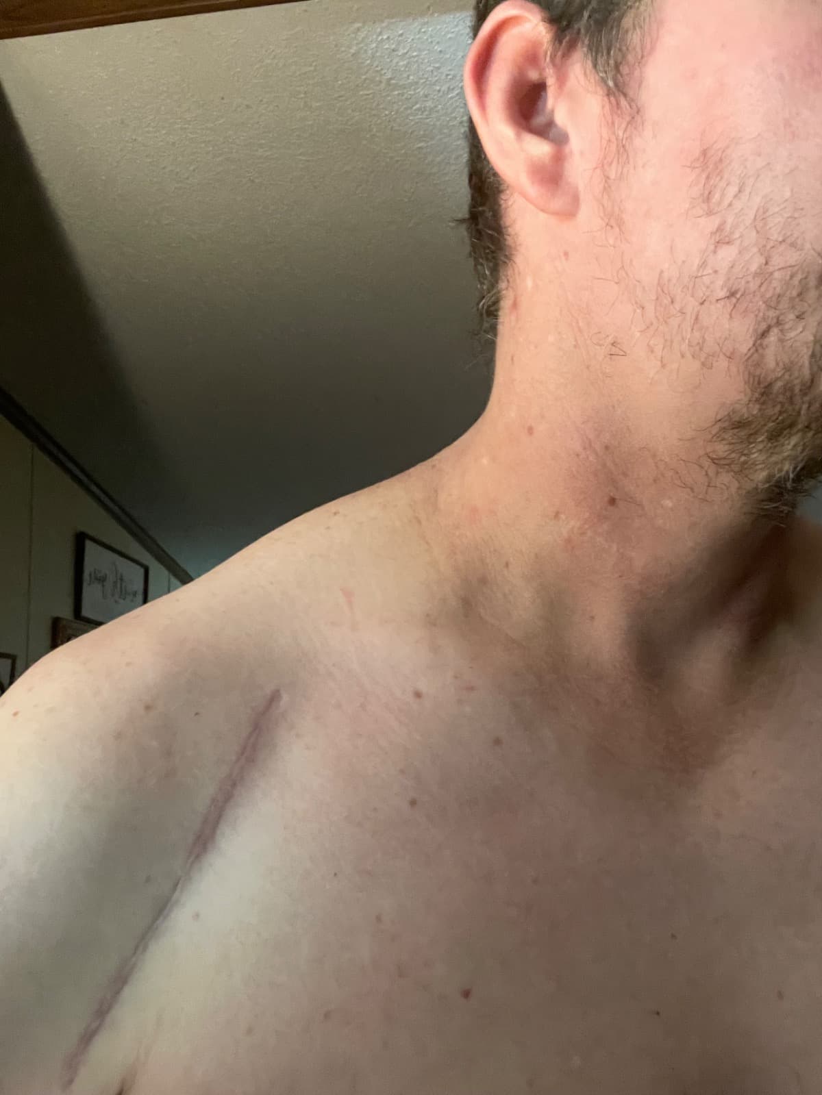 NeedHelpFromNeckSurgery