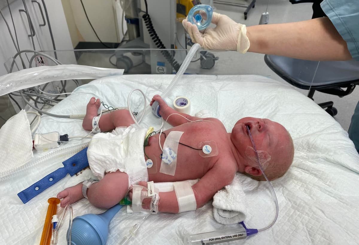 PrematureWinnieNeedsOurHelp