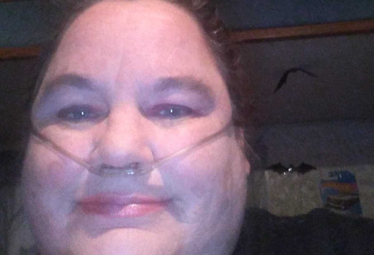 NeedNewOxygenMachineAndFille