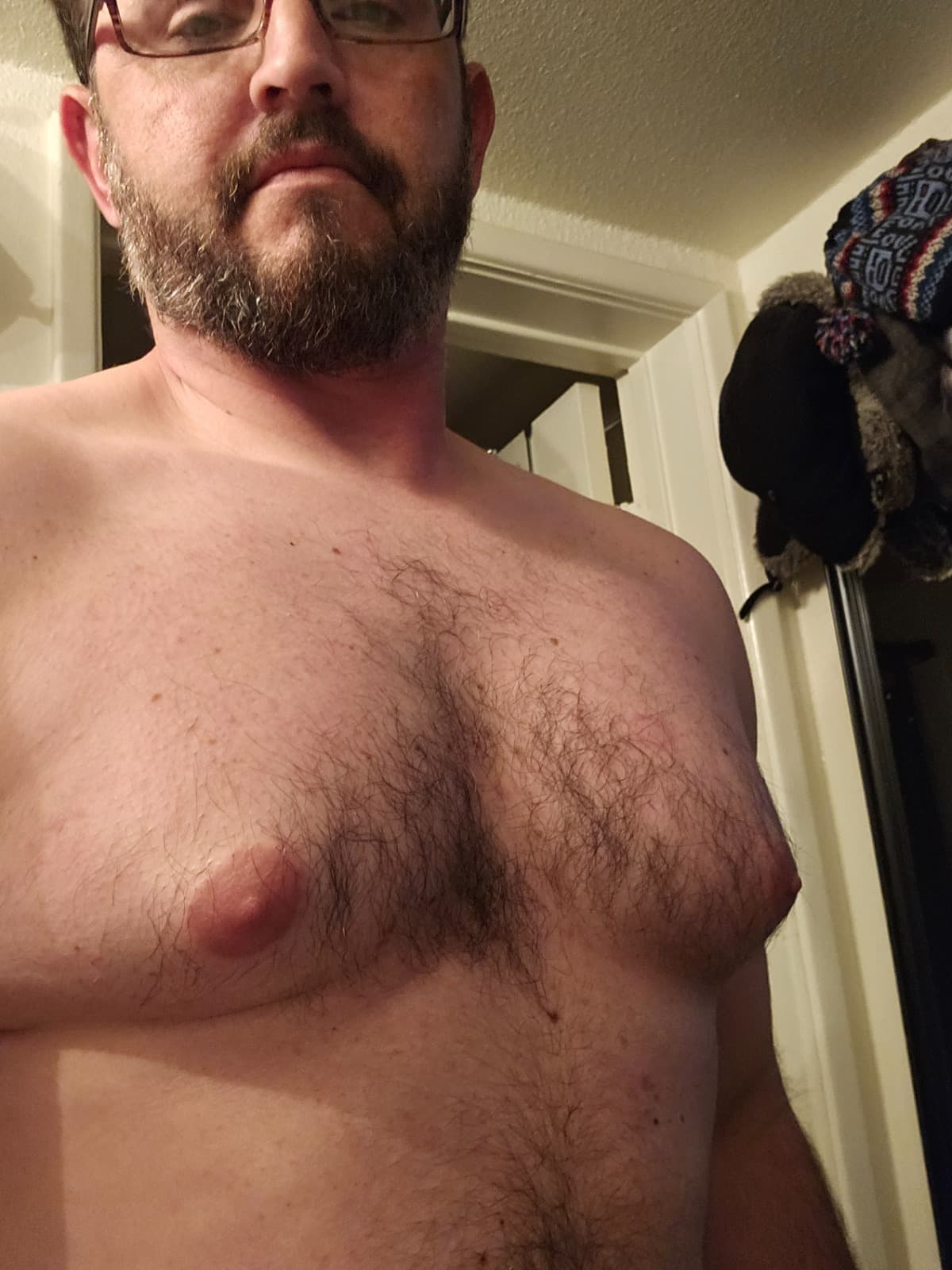 GynecomastiaSurgery