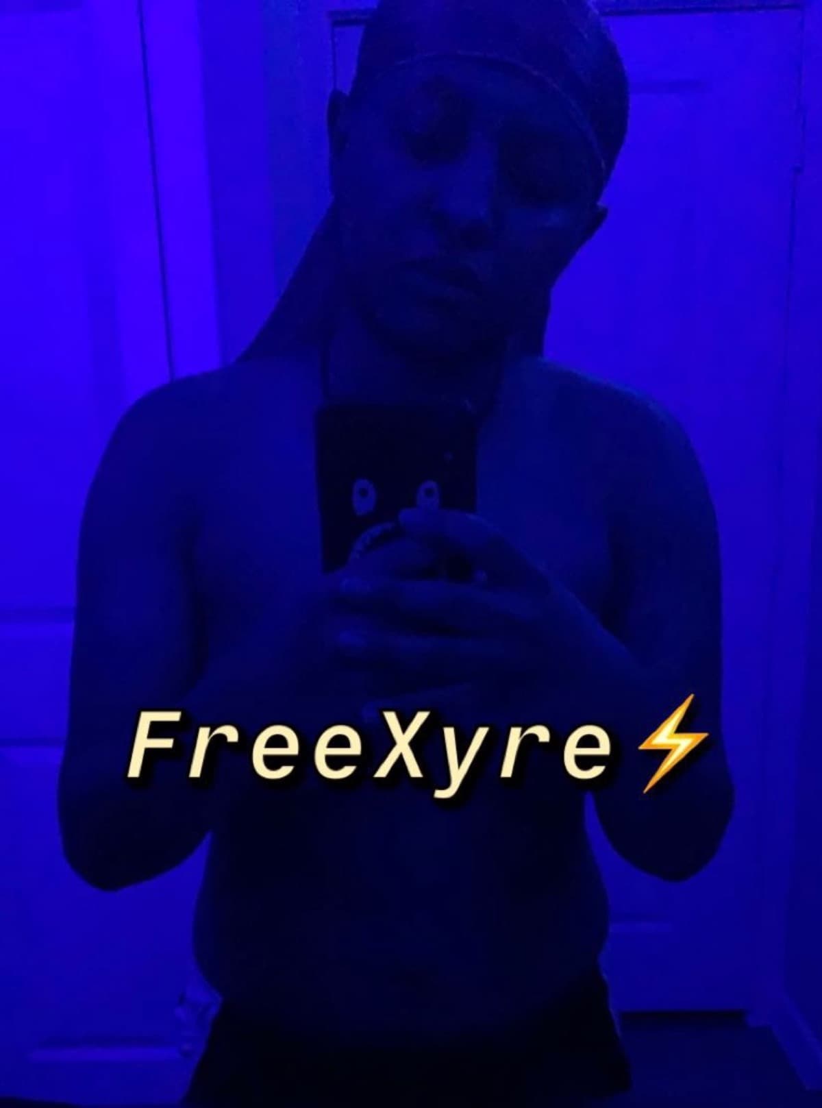 TopSurgery4Xyre