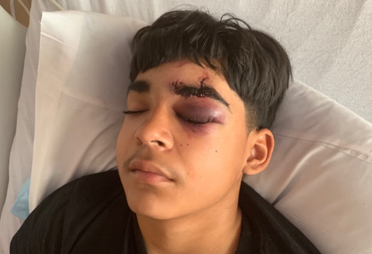 13YearOldBoyWasHitByACar