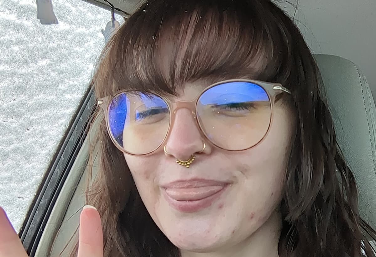 HelpRileyPayForSurgery