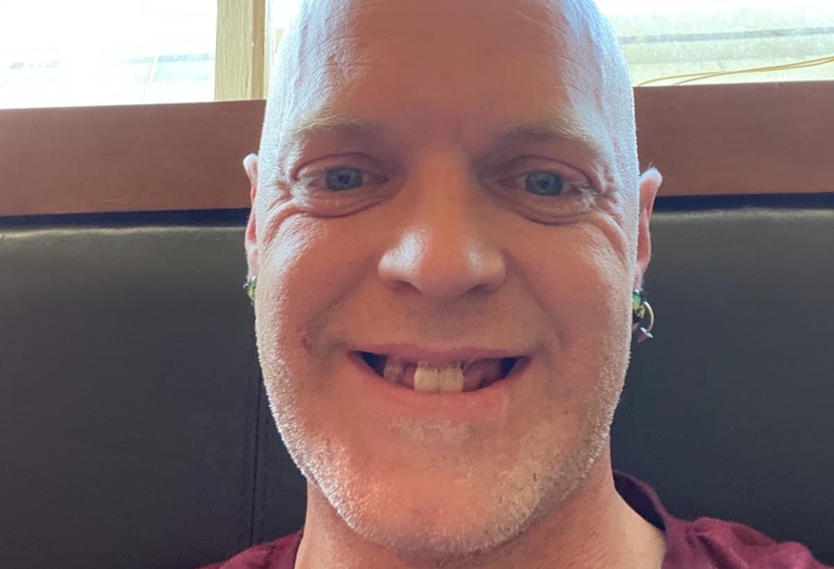 NewTeethForPhilMajorJr