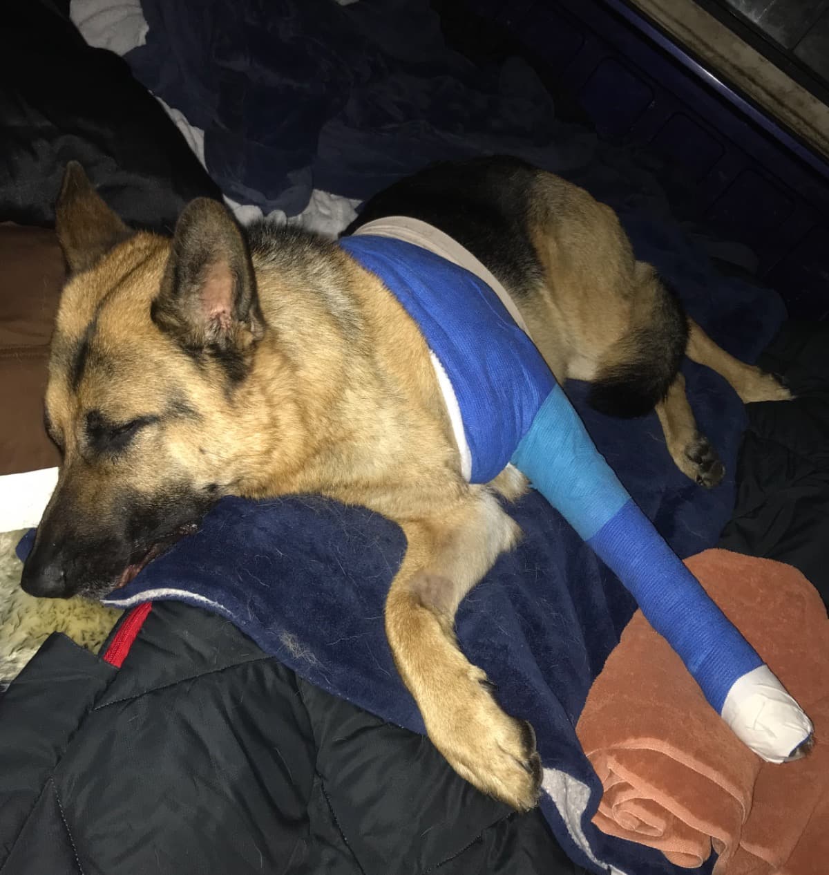 JrsBrokenLeg