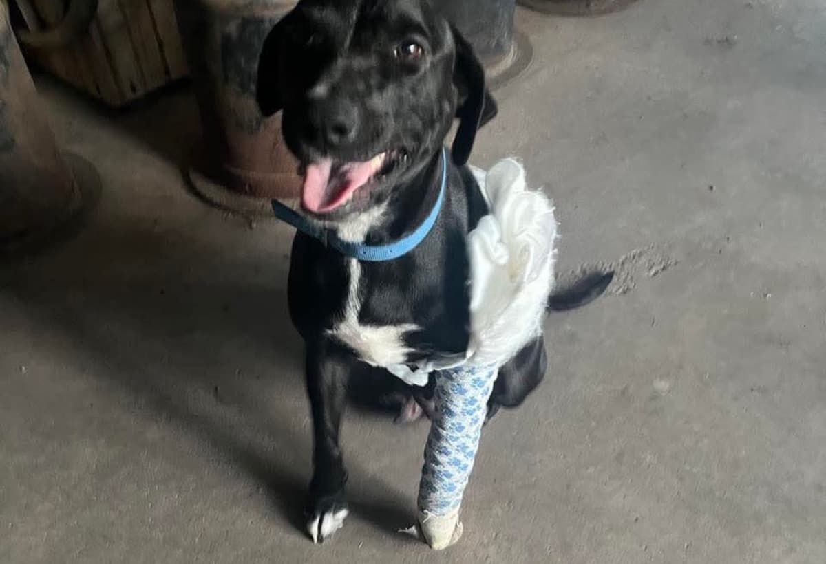 AnnabellesAmputationSurgery