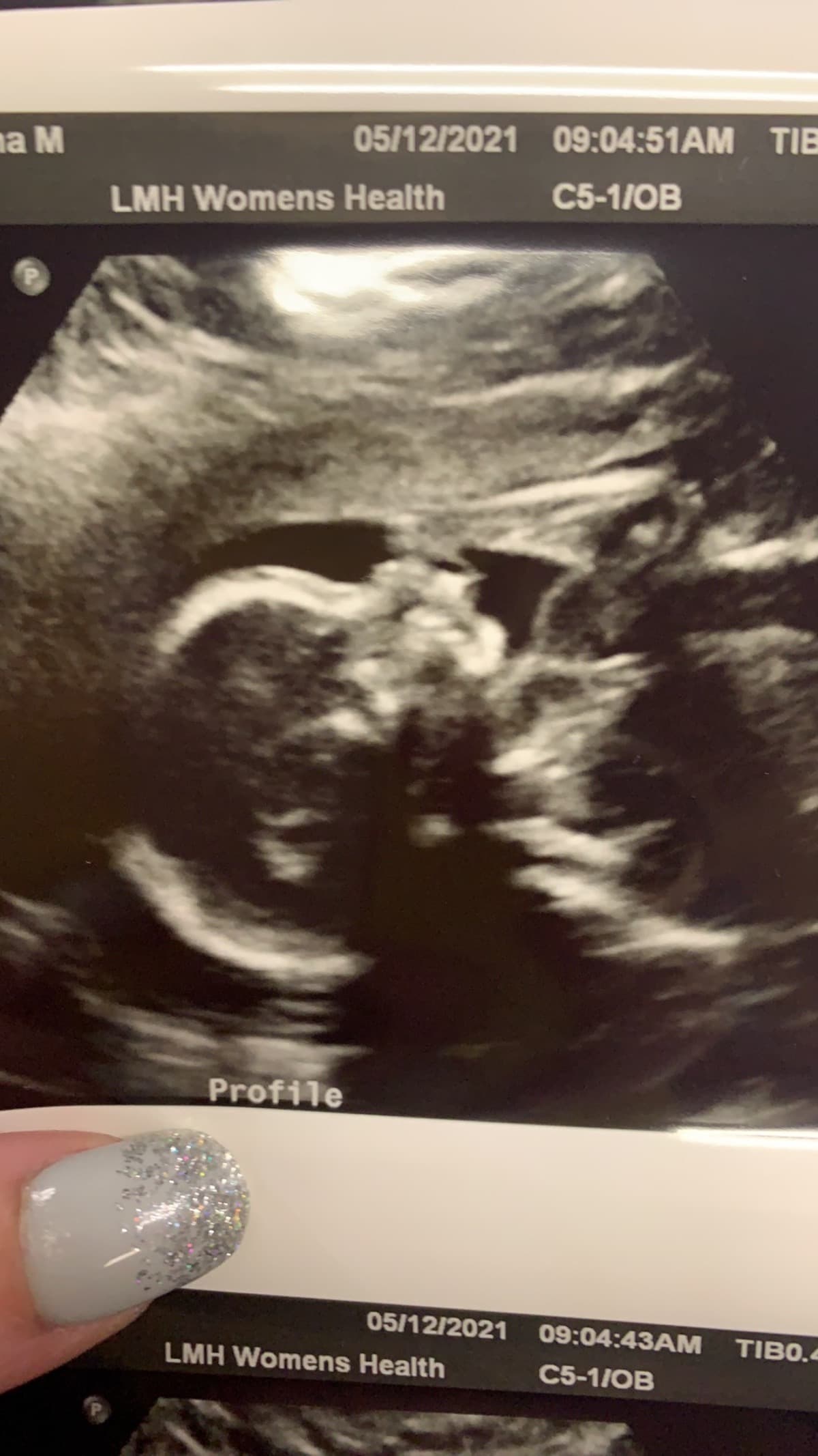 ForMyUnbornDaughter