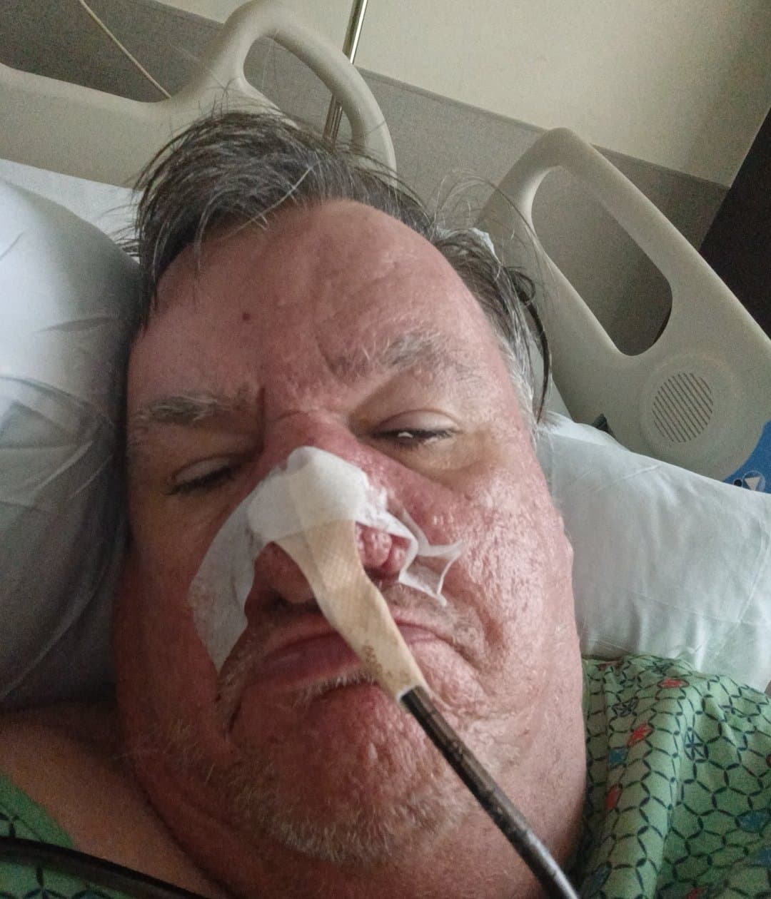 Support Toms Recovery After Surgery