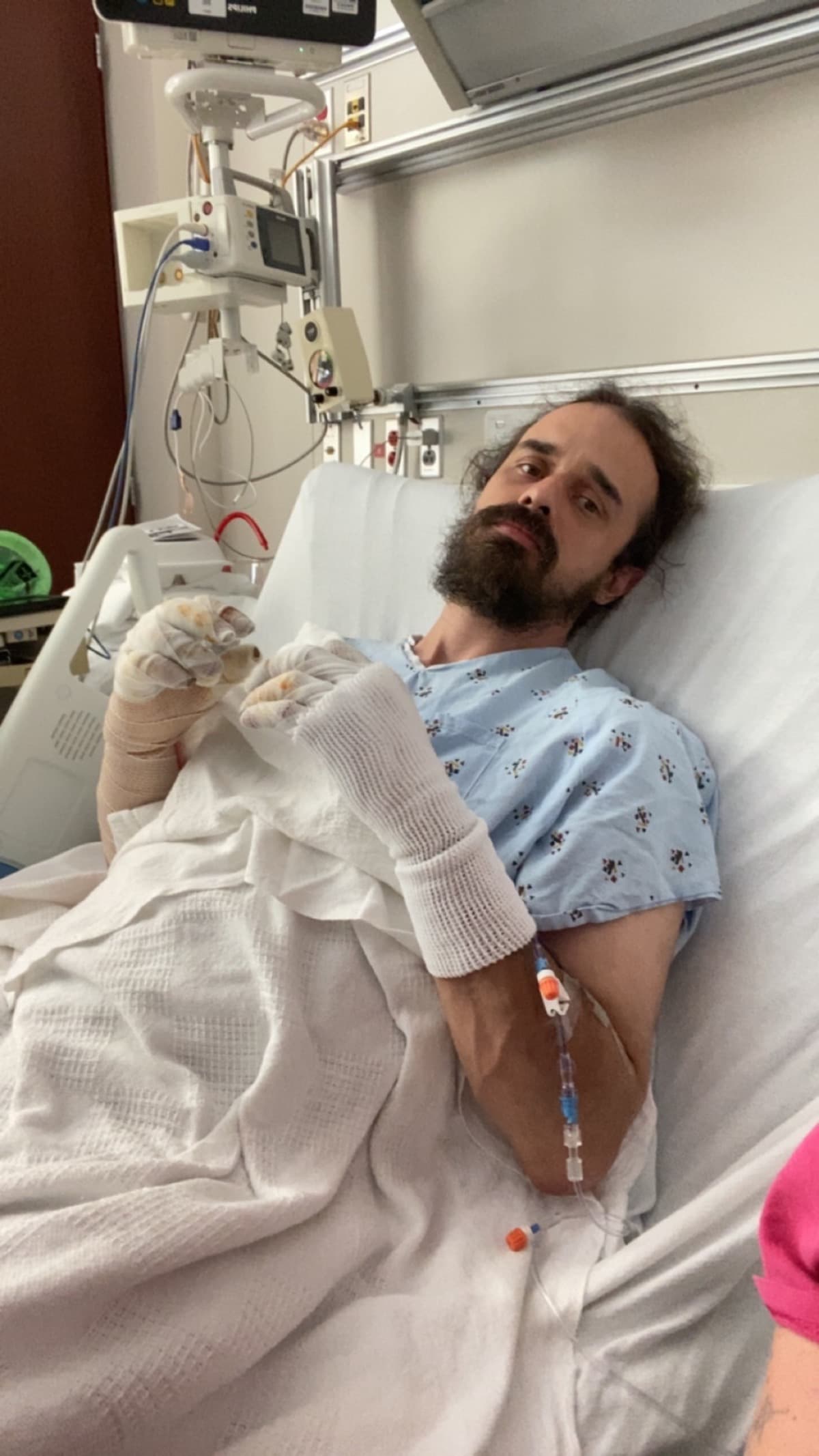 BurnVictimInNeedOfAssistance