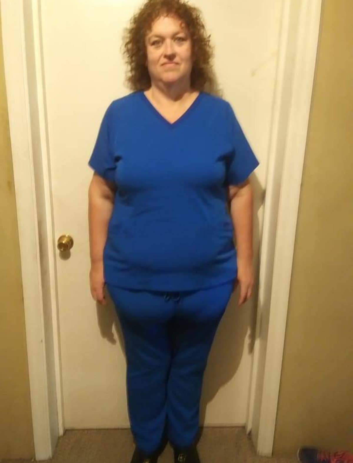 BariatricSurgeryNeededBy