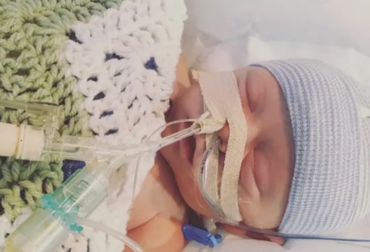 BabyAnjaliUrgentHeartSurgery