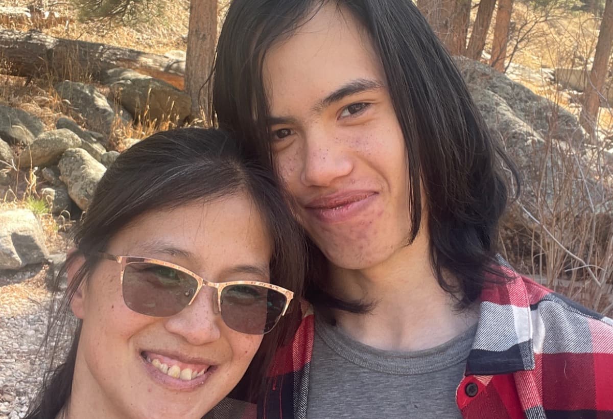 PermanentDentureImplants