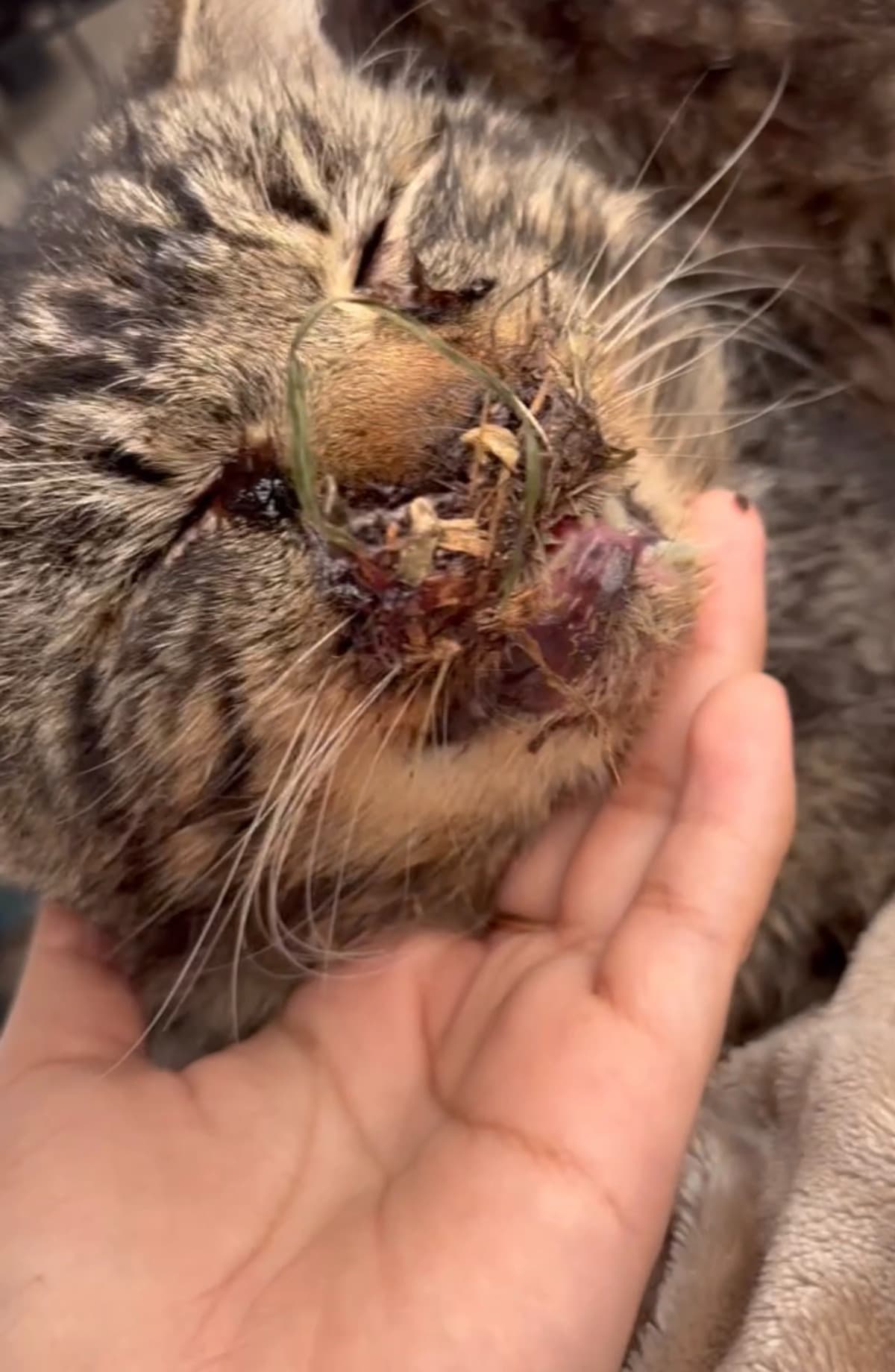 SurgeryForGordoBrokeJaw