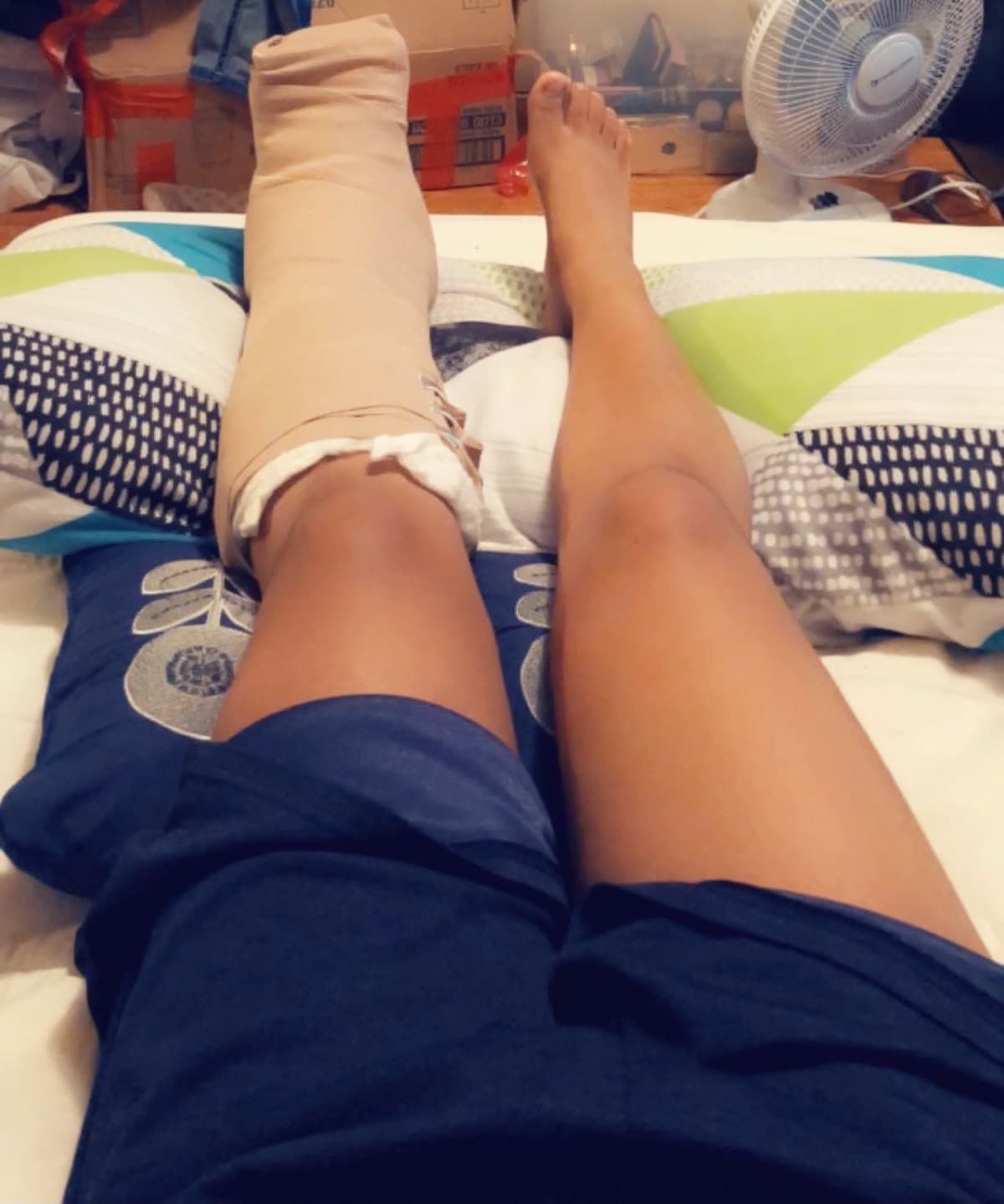 AnkleSurgery