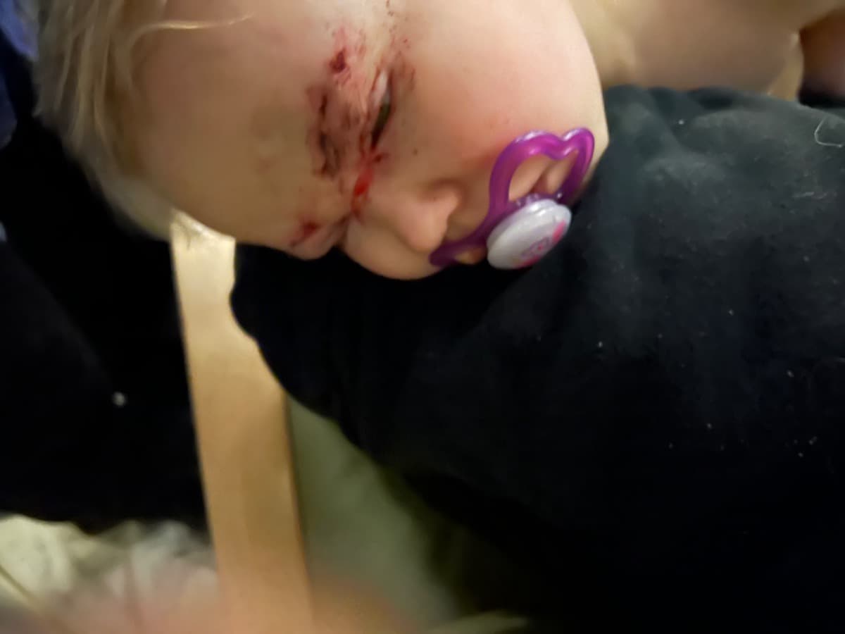 KanesPtosisDonations