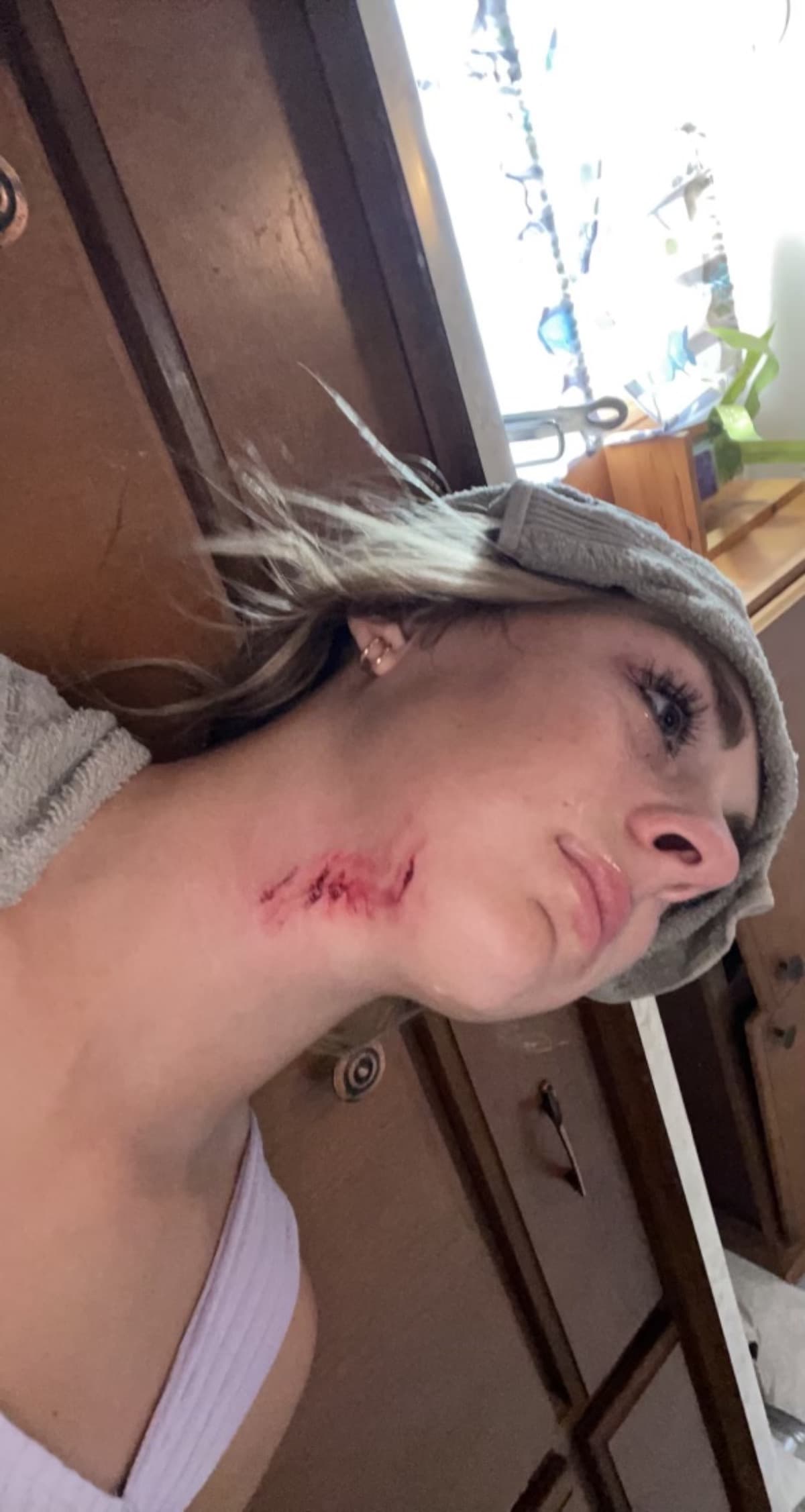 DogAttack