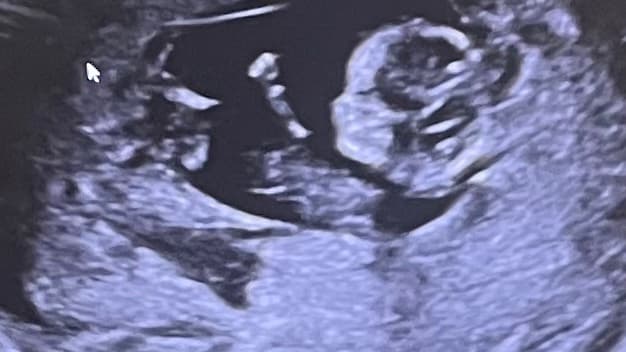 Help A Struggling Mom Provide For Her Baby